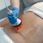 How Lifestyle Habits Affect Body Contouring Results